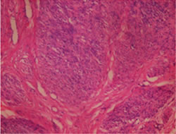 figura3